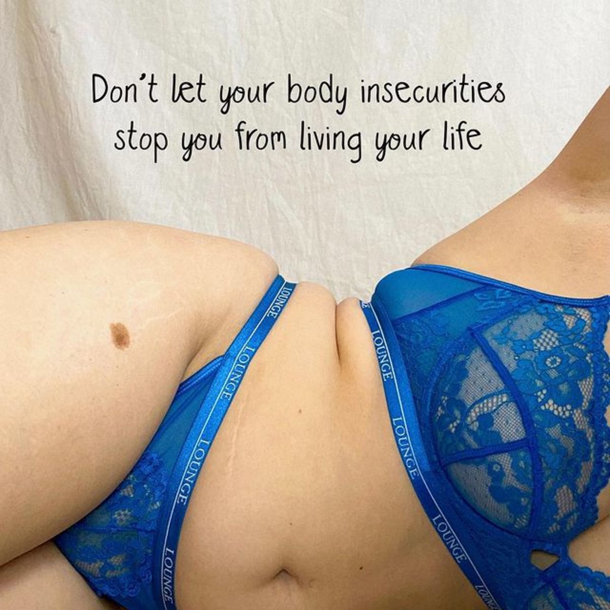 How to Deal with Body Dismorphia and Body Insecurities