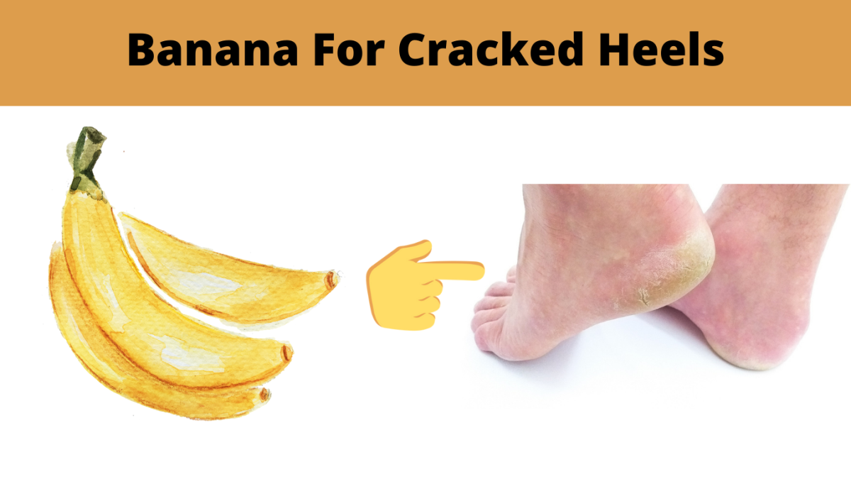 Banana for cracked heels