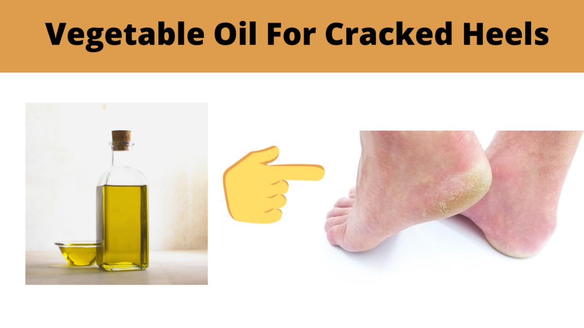 Vegetable oil for cracked heels