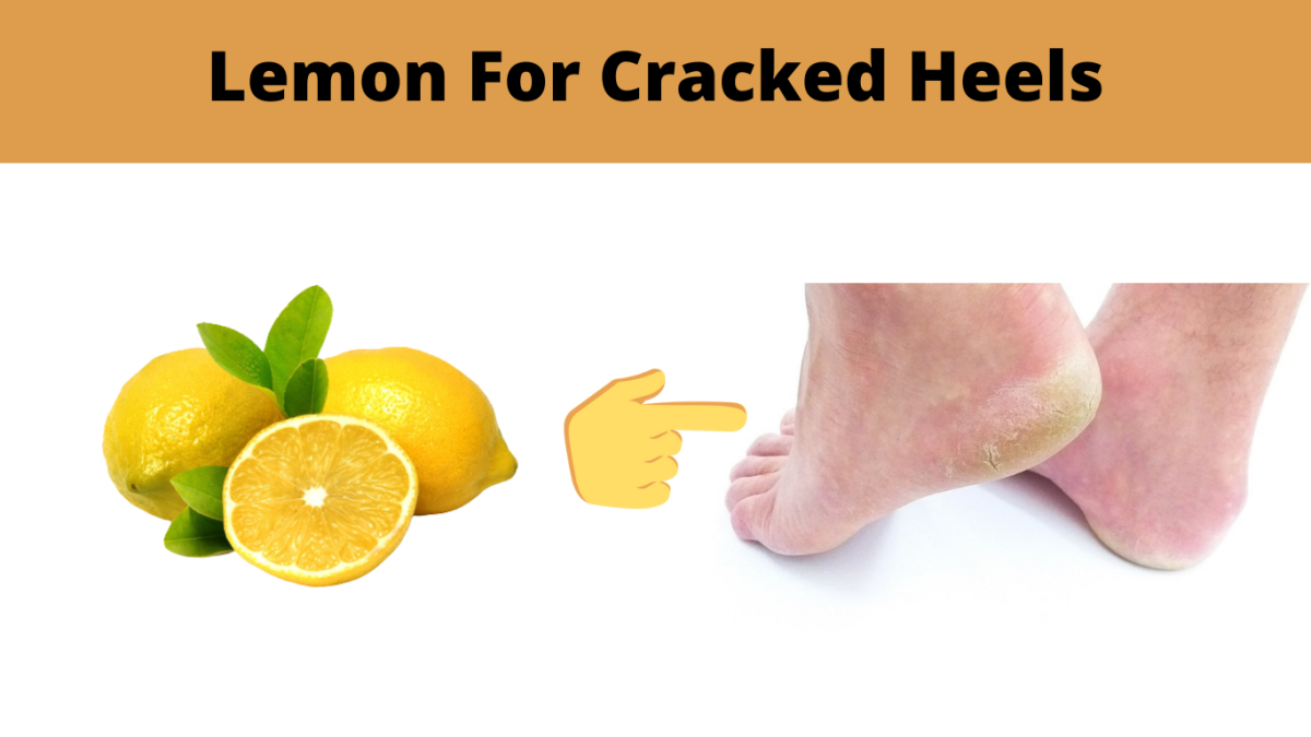 Lemon for cracked heels
