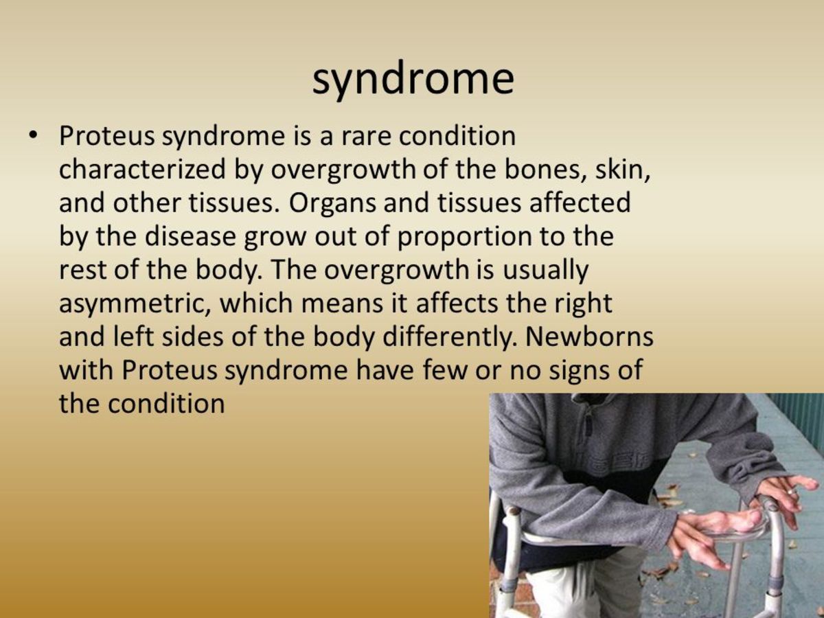 Proteus Syndrom