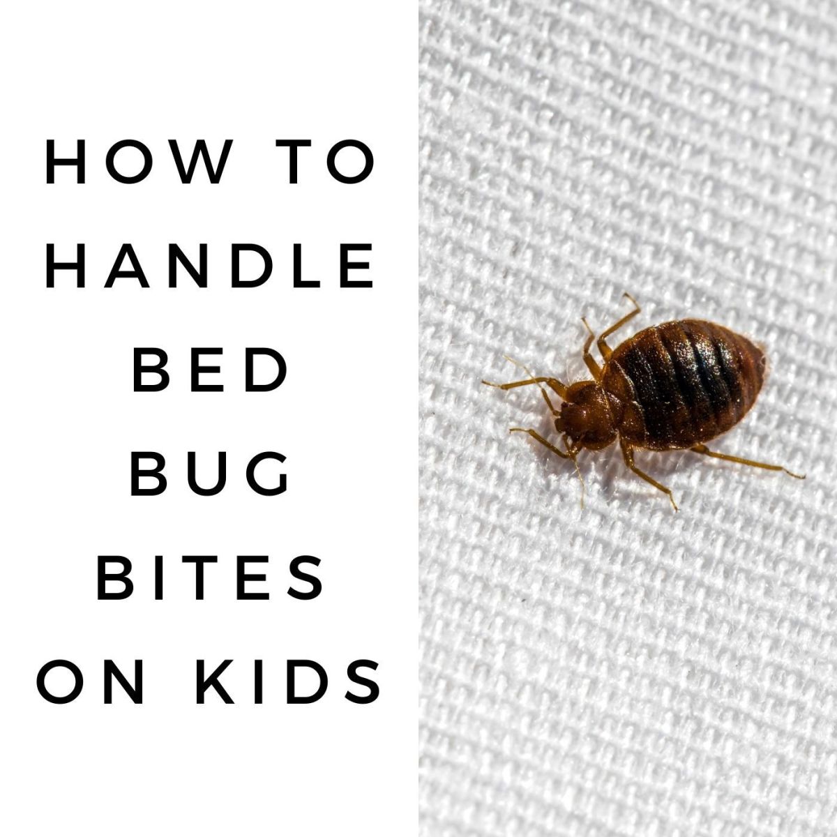 How to Handle Bed Bug Bites on Kids