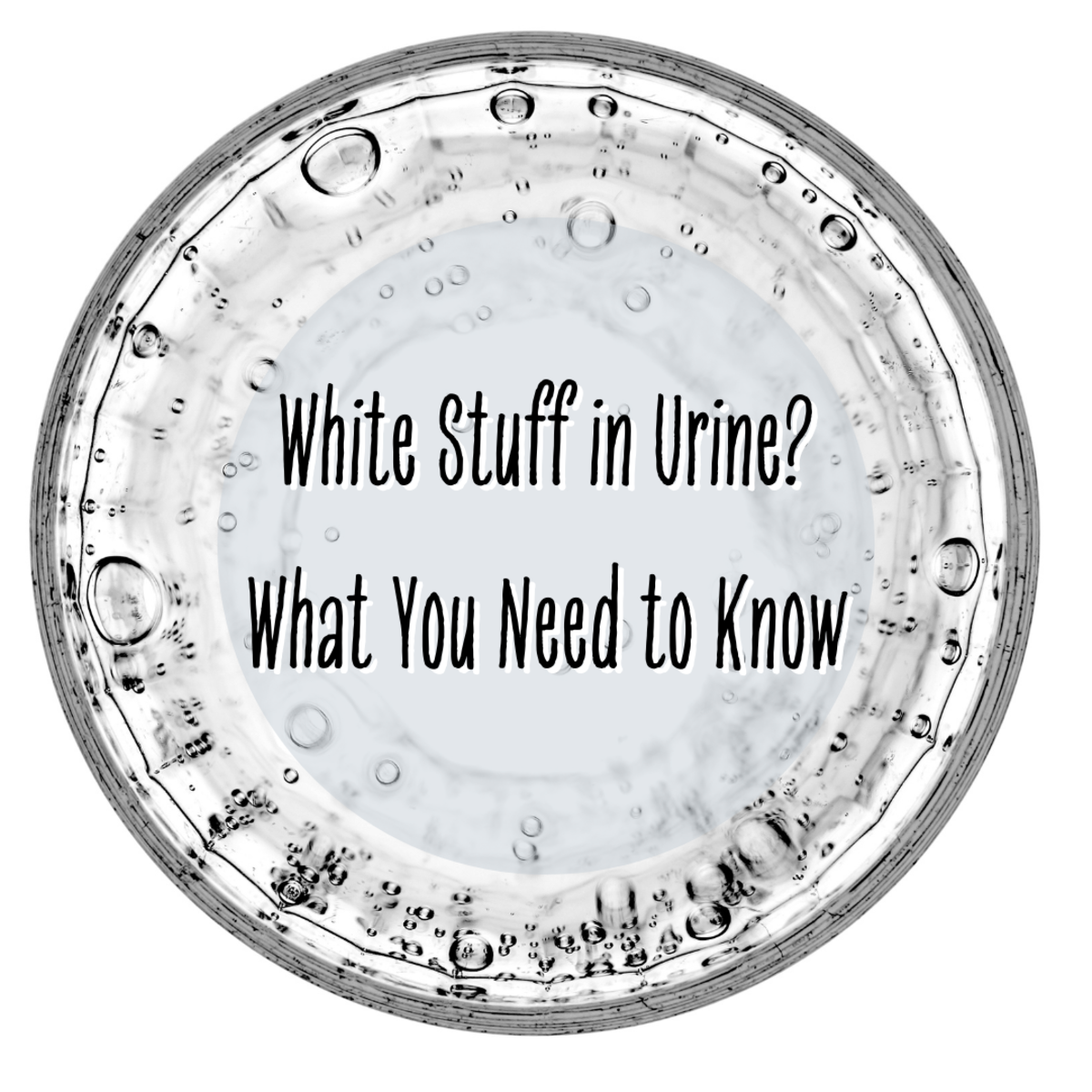 White Stuff In Urine Here s What You Should Know YouMeMindBody