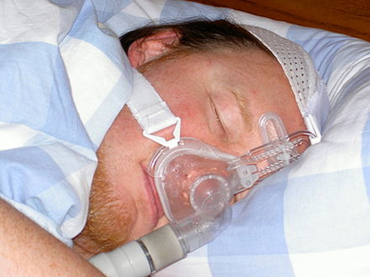 Are You at Risk for Sleep Apnea?