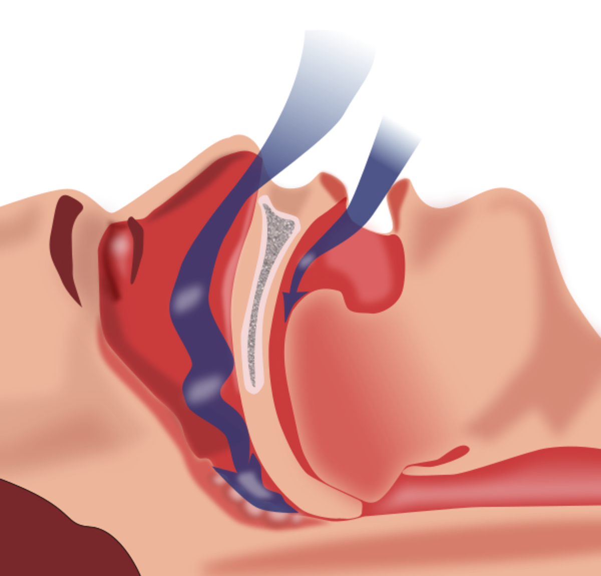 are-you-at-risk-for-sleep-apnea