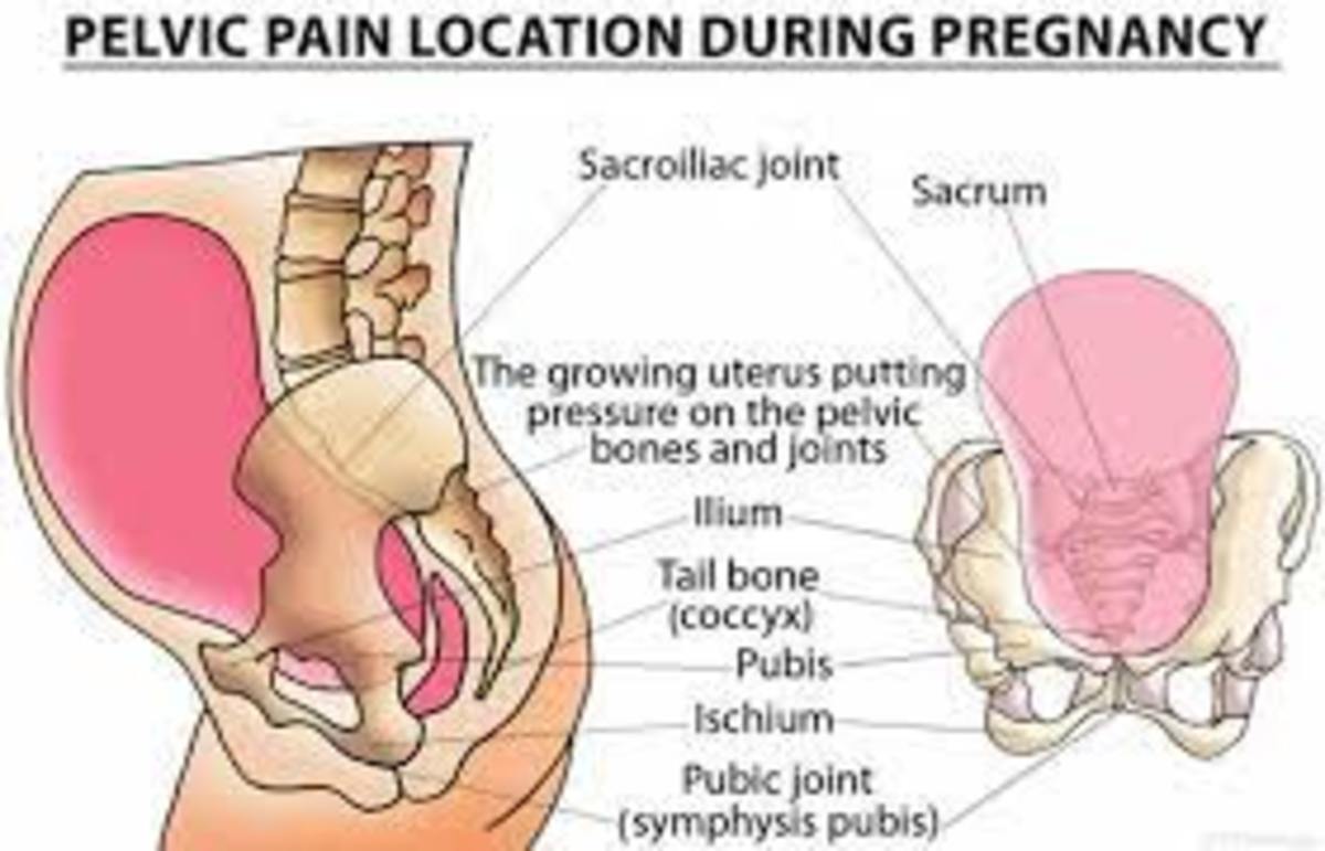 musculoskeletal-disorders-in-pregnancy-and-postpartum