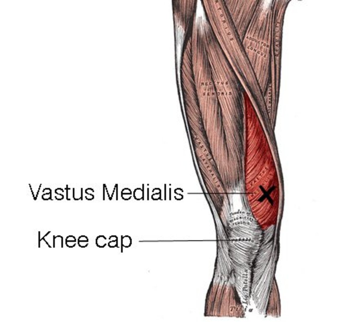 diagram showcsing the vastus medialis and how it protects the knee cap and stabilizes the knee joint