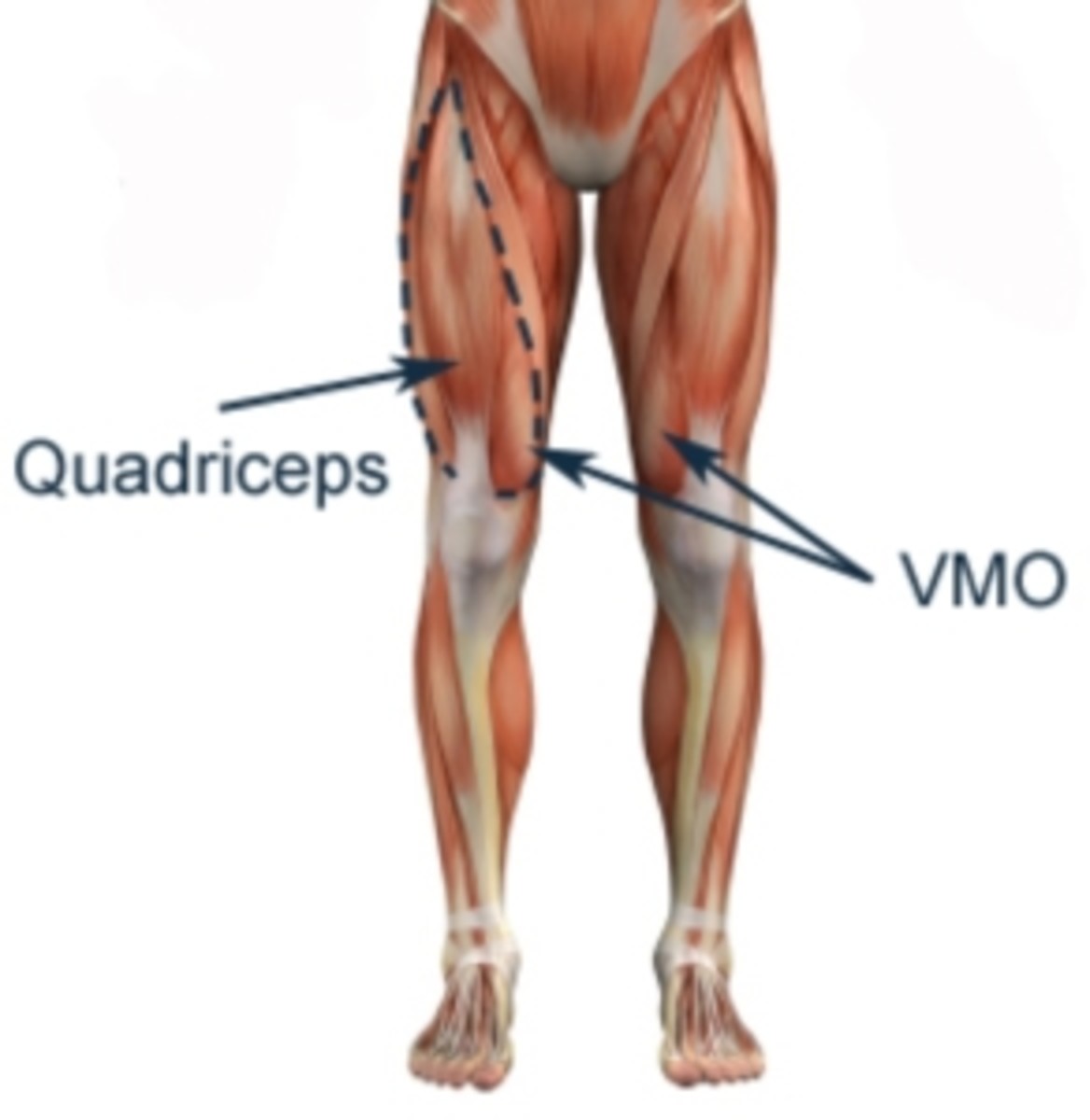 diagram of the human body showcasing the quadriceps and the VMO vastus medialis oblique