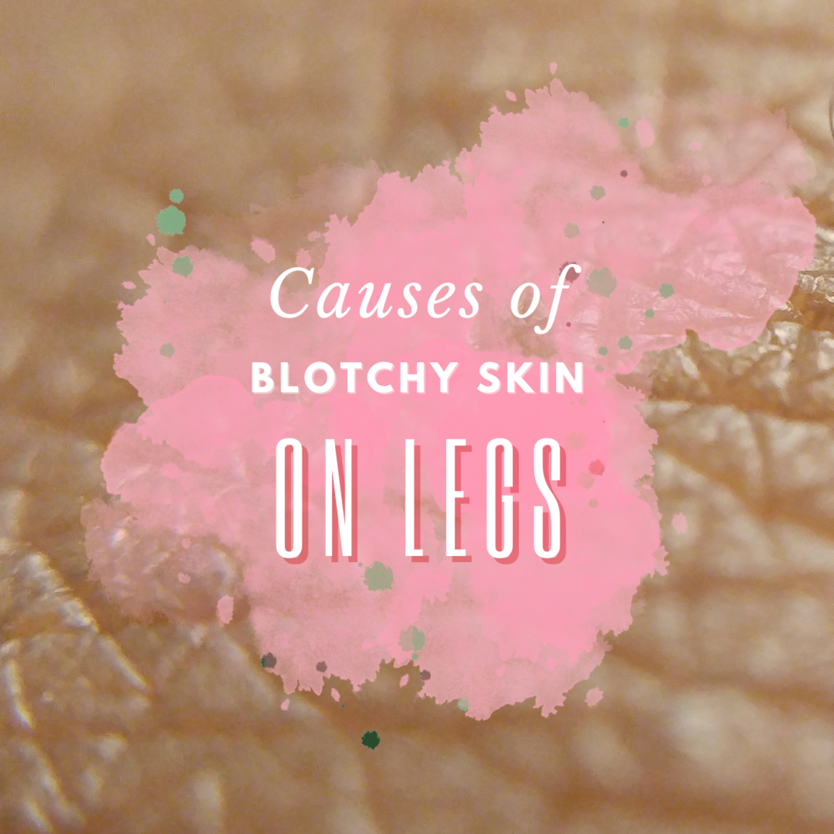 Blotchy skin on the legs has several potential causes—read on to find out more.