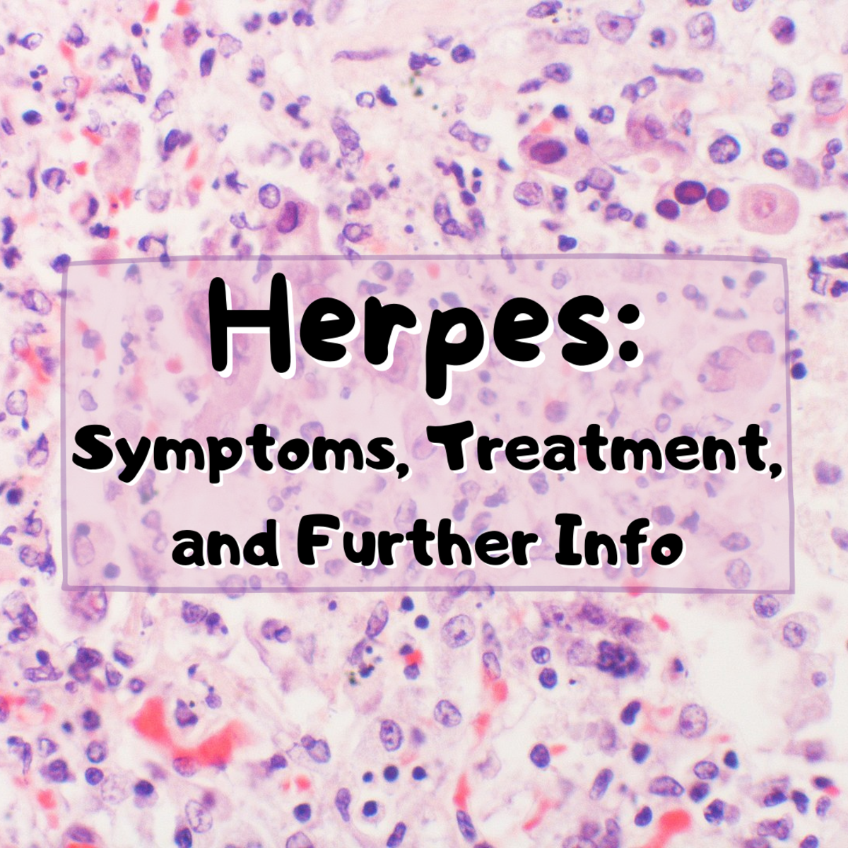 This article discusses herpes, a common disease present in a large portion of the population. Read on to learn about what herpes is, its symptoms, and the available treatment options.