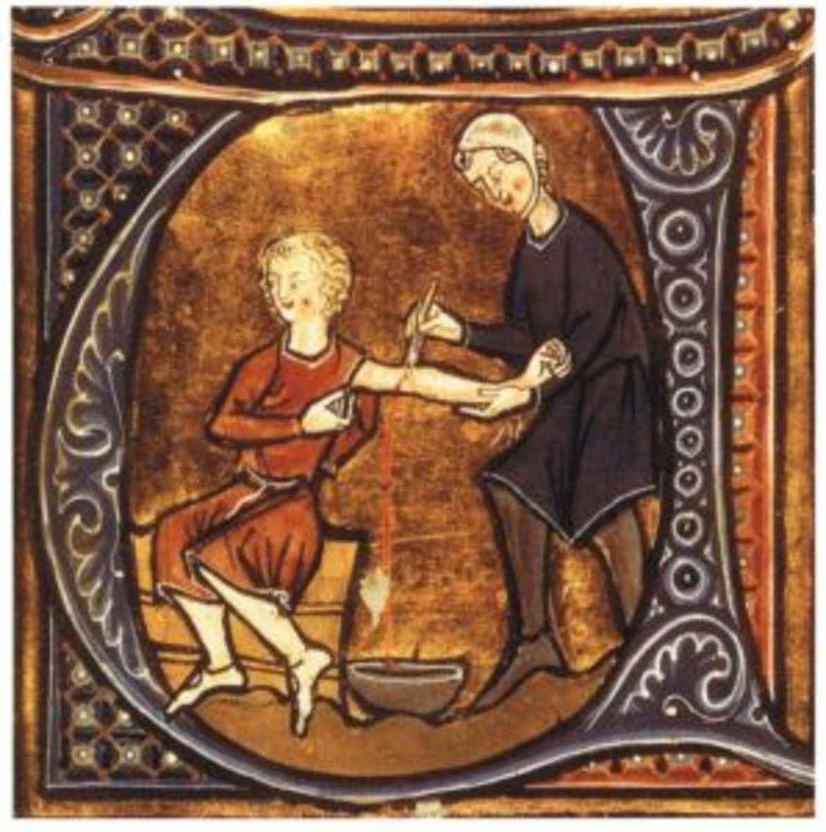 Bloodletting: The proposed cure for almost every medieval malady.