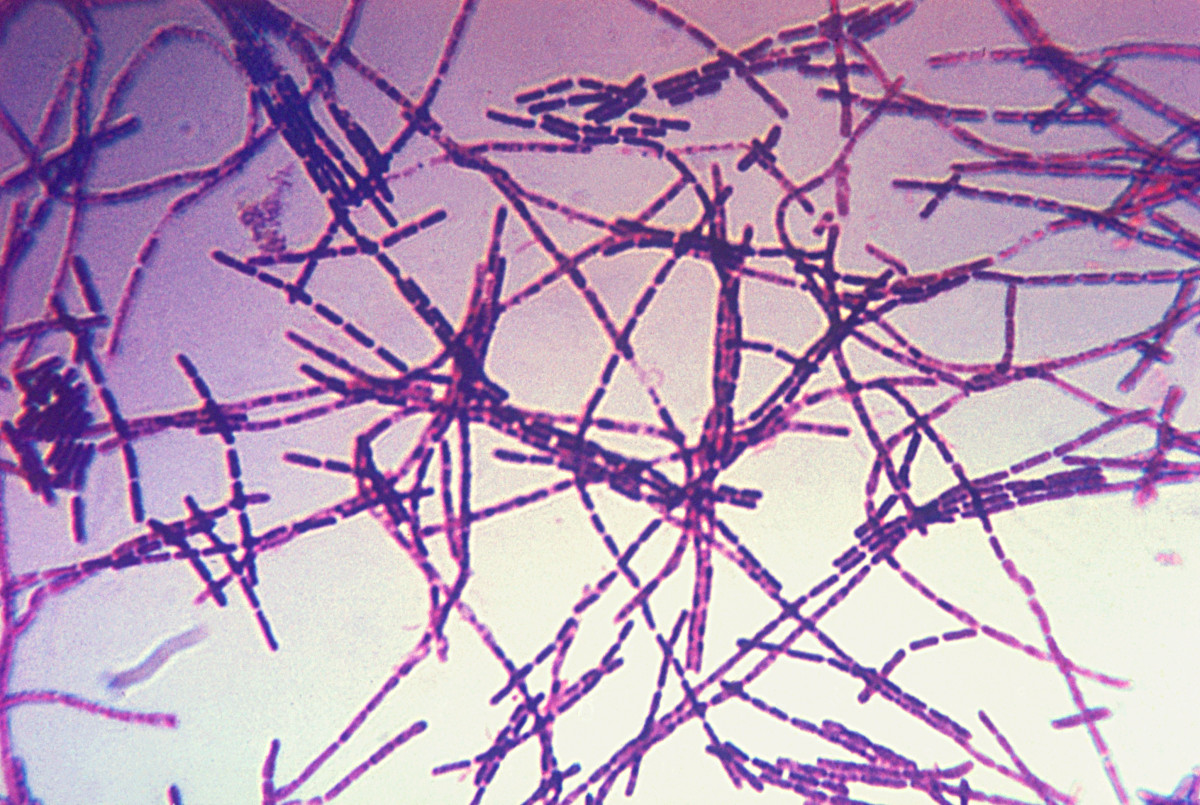 Key Information About Anthrax