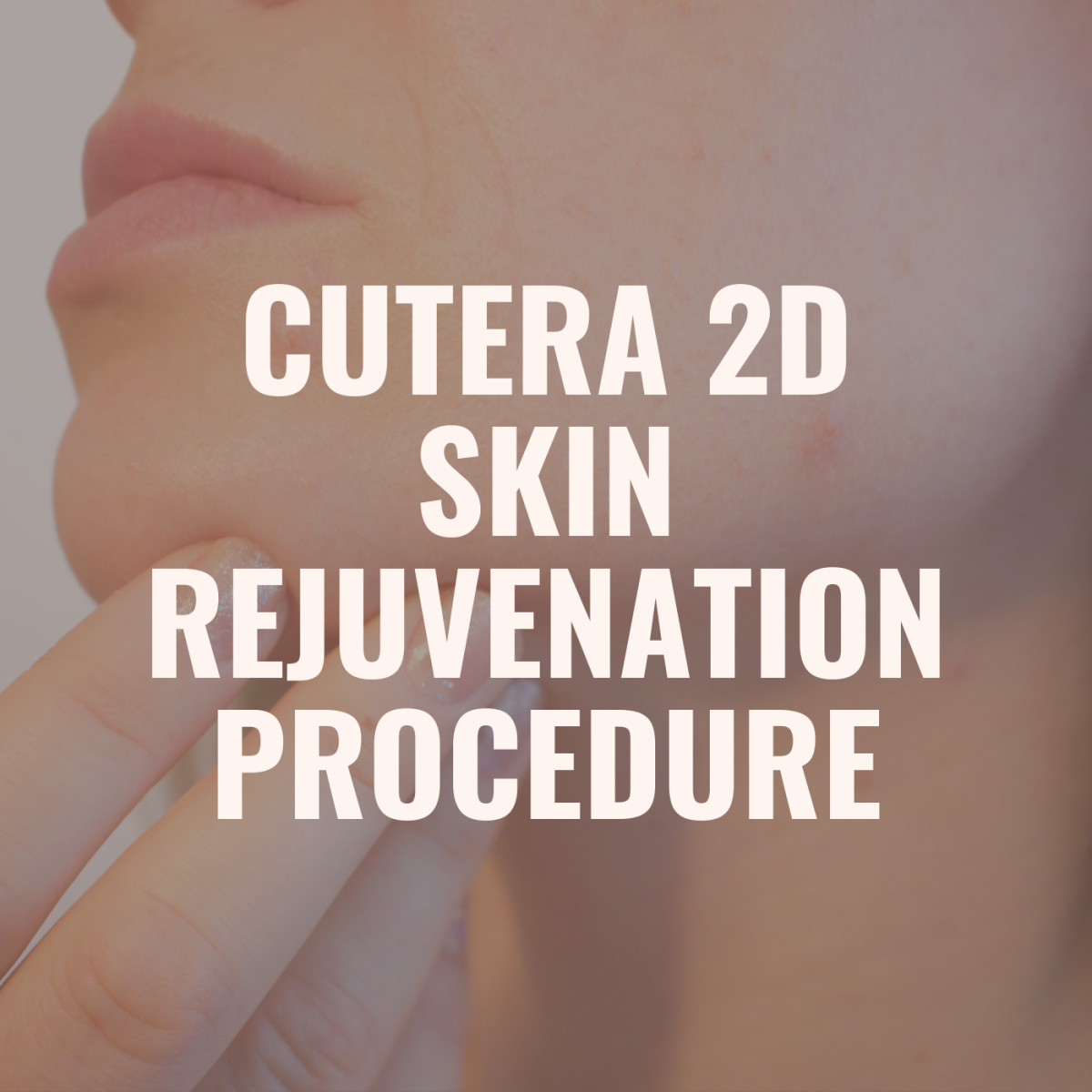 Review of Cutera 2D Skin Rejuvenation Procedure