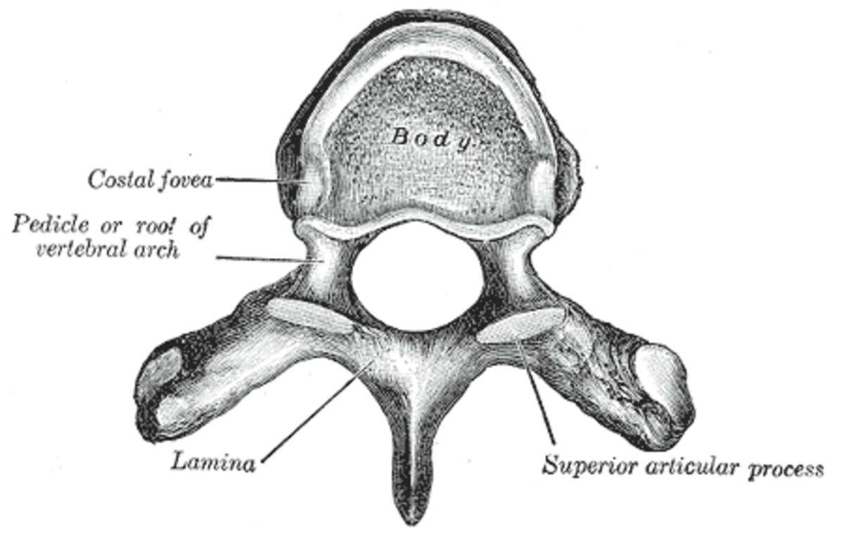 This is a vertebra with a normal canal. Spinal stenosis is the narrowing of this canal.