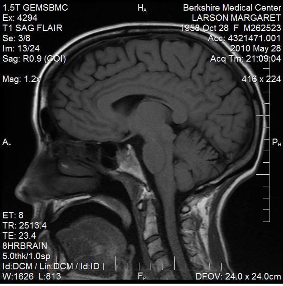 Brain_MRI, photo By maggies_insides, source Photobucket - Which is better for you? Beer or Red Wine