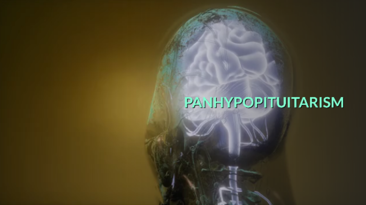 panhypopituitarism