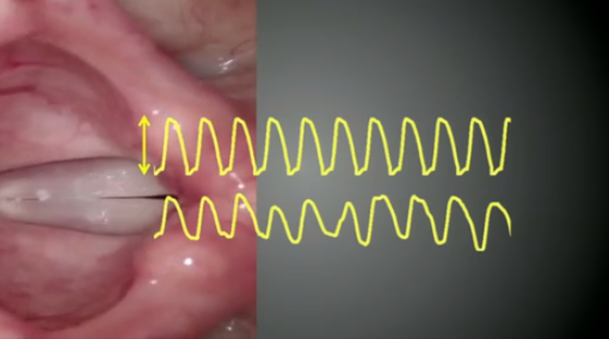Vocal cords (bands, folds) producing vibrato, a remarkable sign of good vocal quality