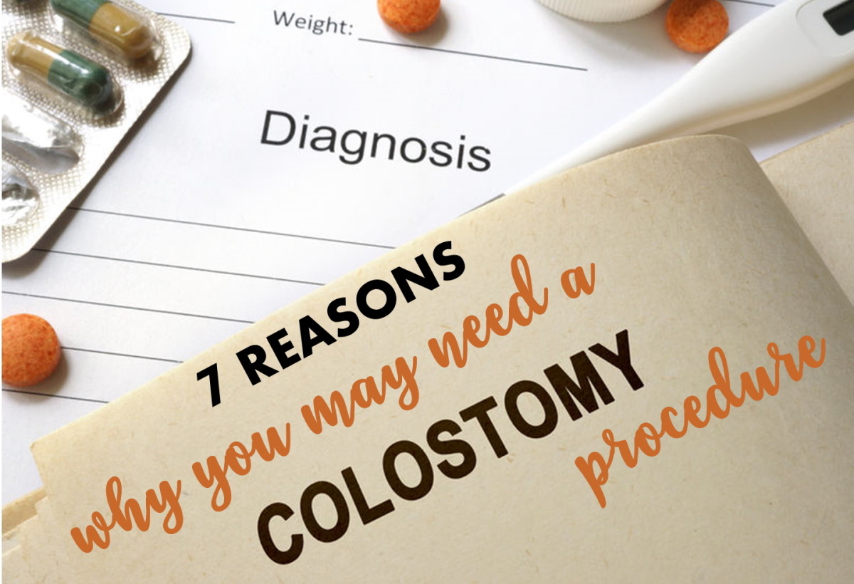 7 Reasons for Colostomy Surgical Procedure