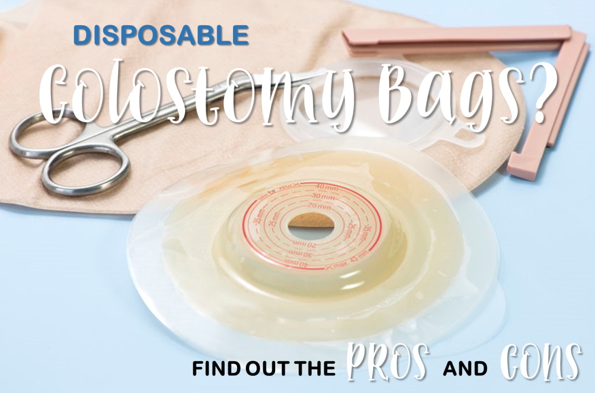 Disposable Colostomy Bags: My Experience