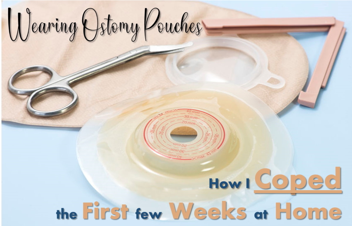 How I Coped With Wearing Colostomy Bags