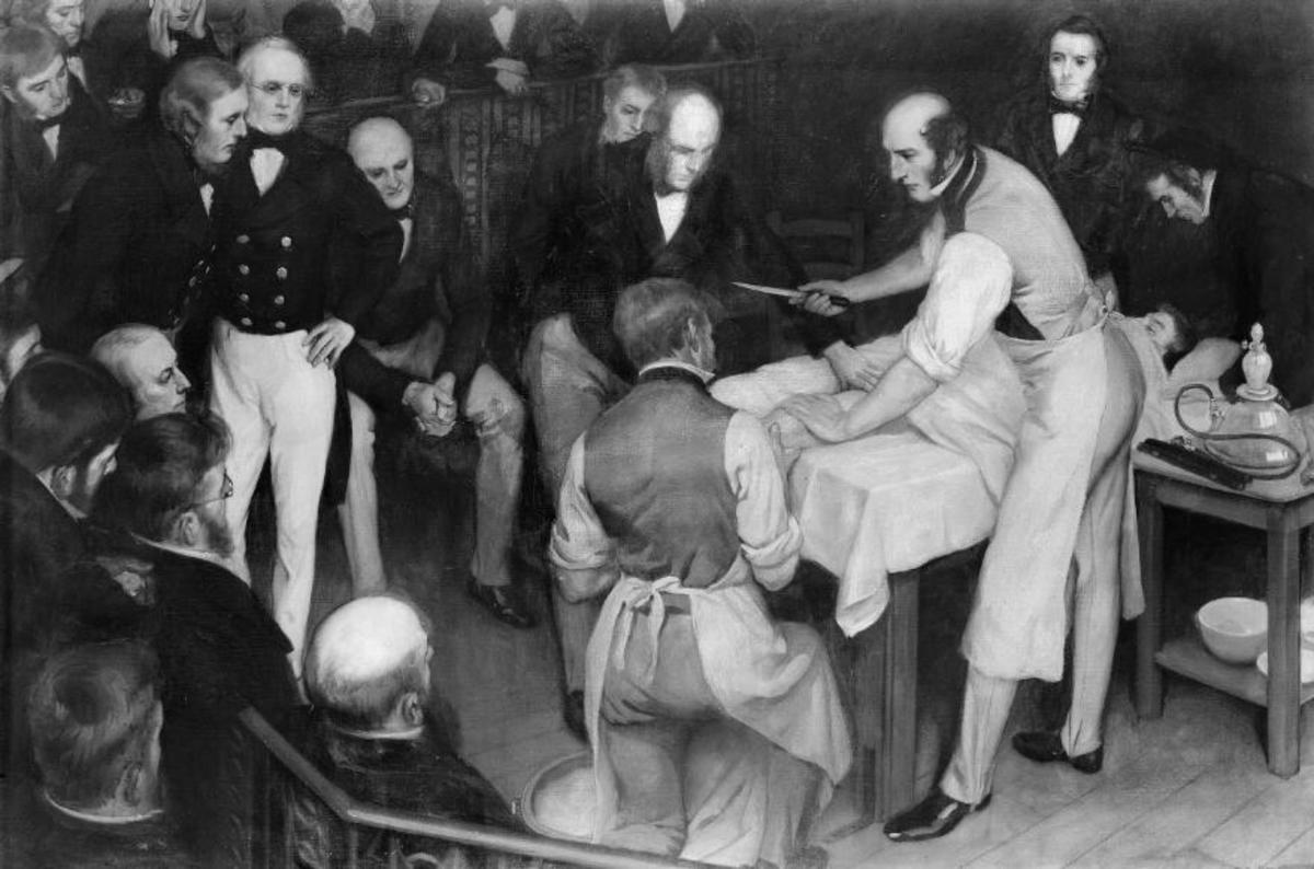 Robert Liston: Speedy Victorian Surgeon