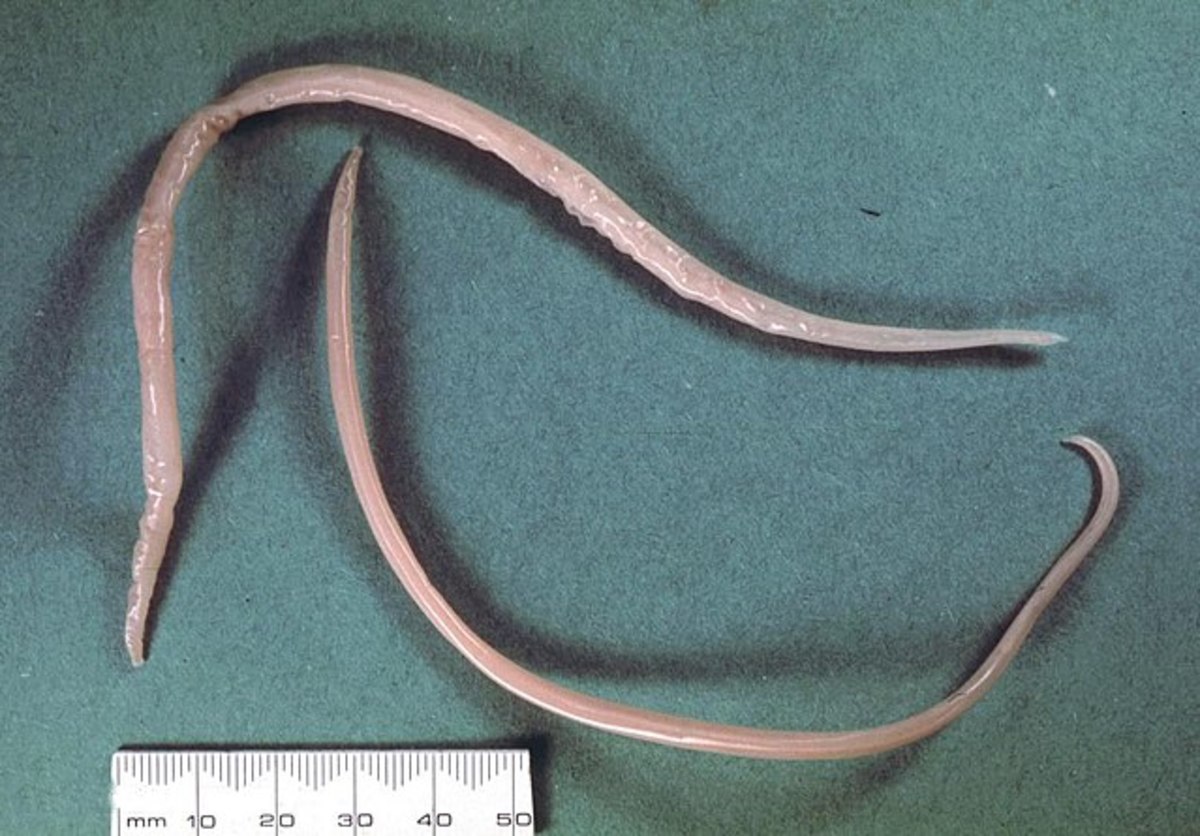 The infamous ascaris roundworm.