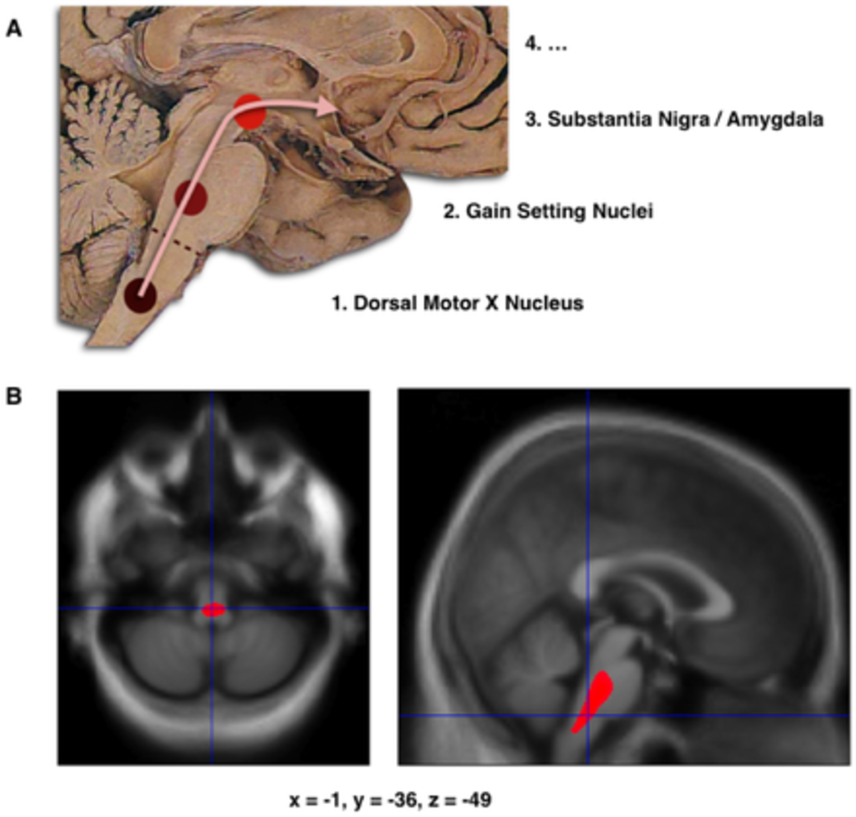 Brain Effects for Parkinson's Disease pixabay.com