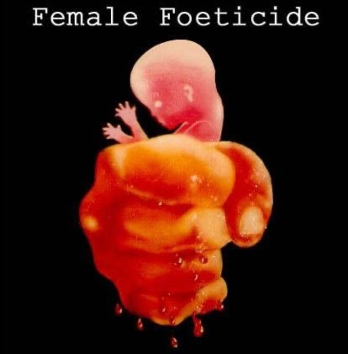 Female Foeticide - Let an Innocent Child Live