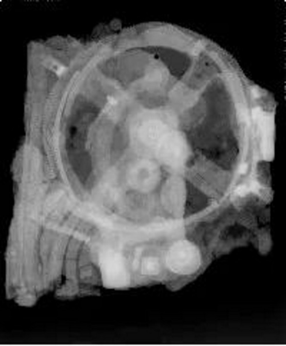 X-ray of the Antikythera device, 1971