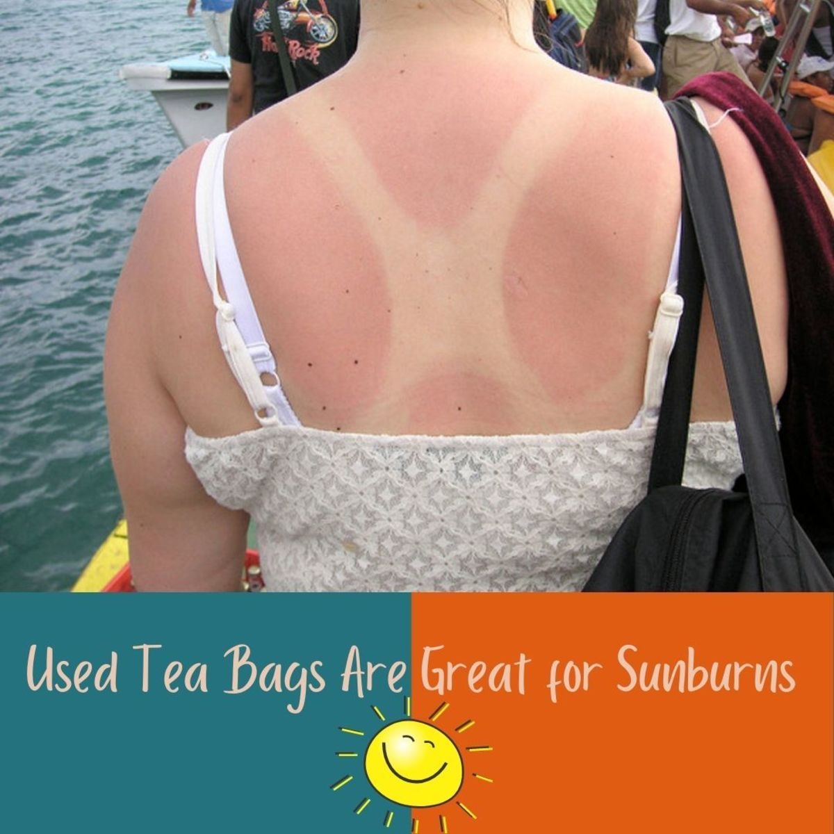Help relieve pain from sunburns and other ailments with tea bags.