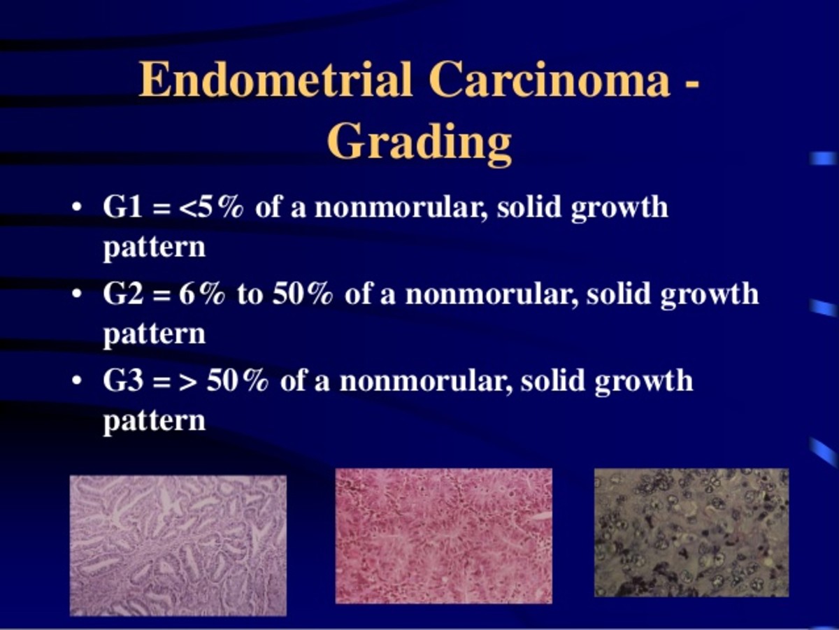 surviving-endometrial-cancer-patient-s-lounge