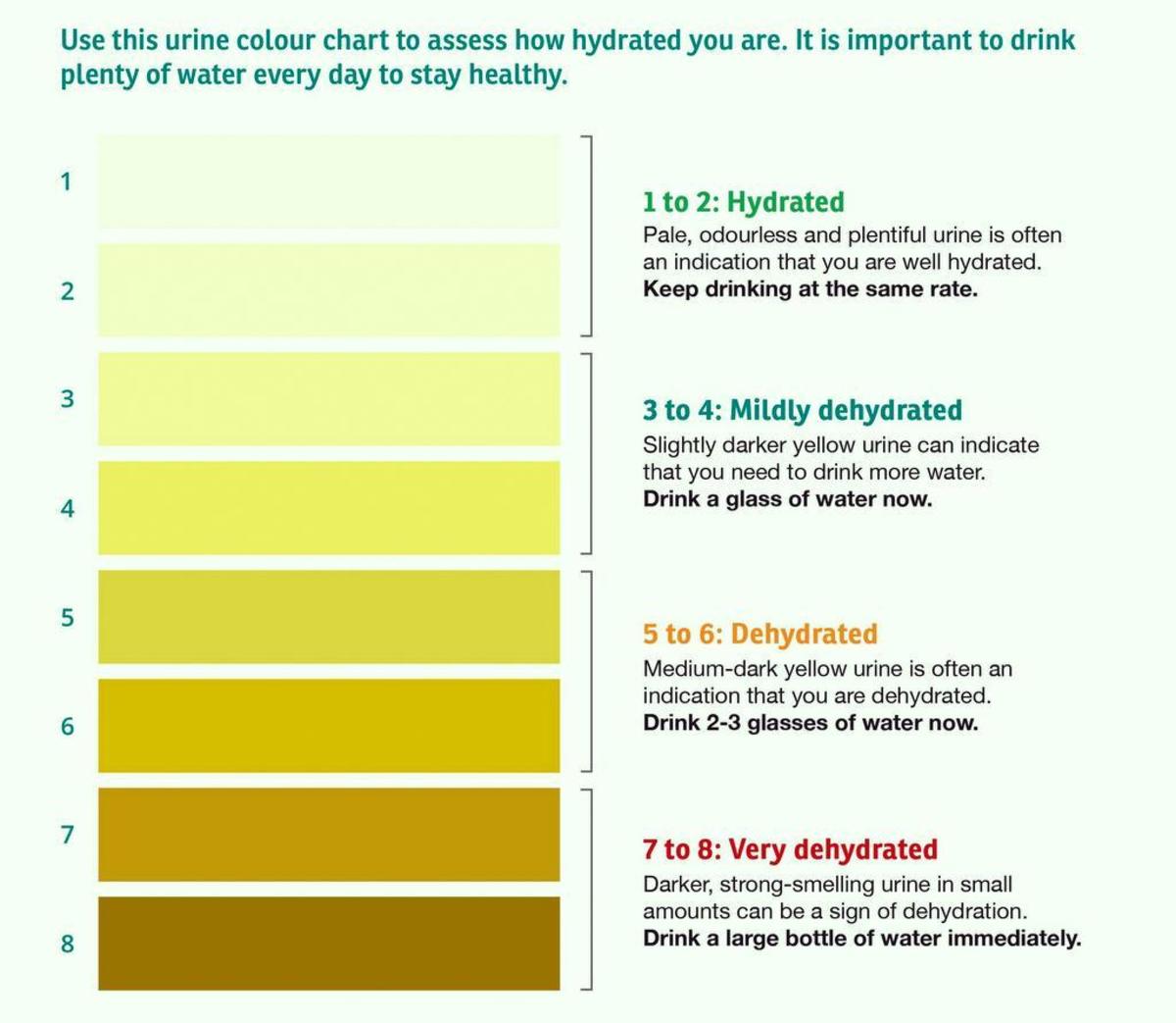 Urine color chart - Use this as a guide only and should not replace the advice of medical personnel.