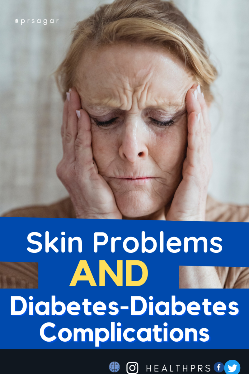 Skin Problems And Diabetes Complications