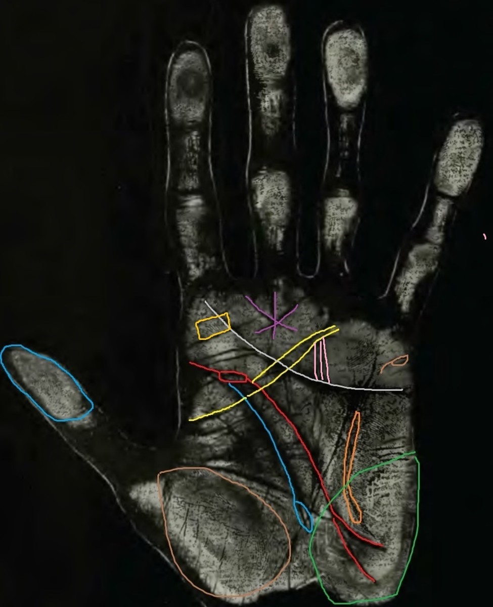 Suicide Lines and Signs in Palmistry