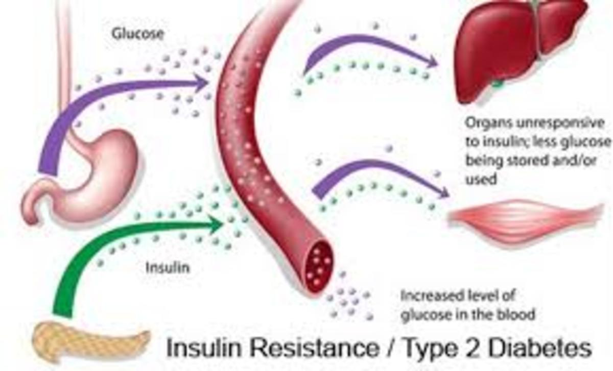 insulinresistance2
