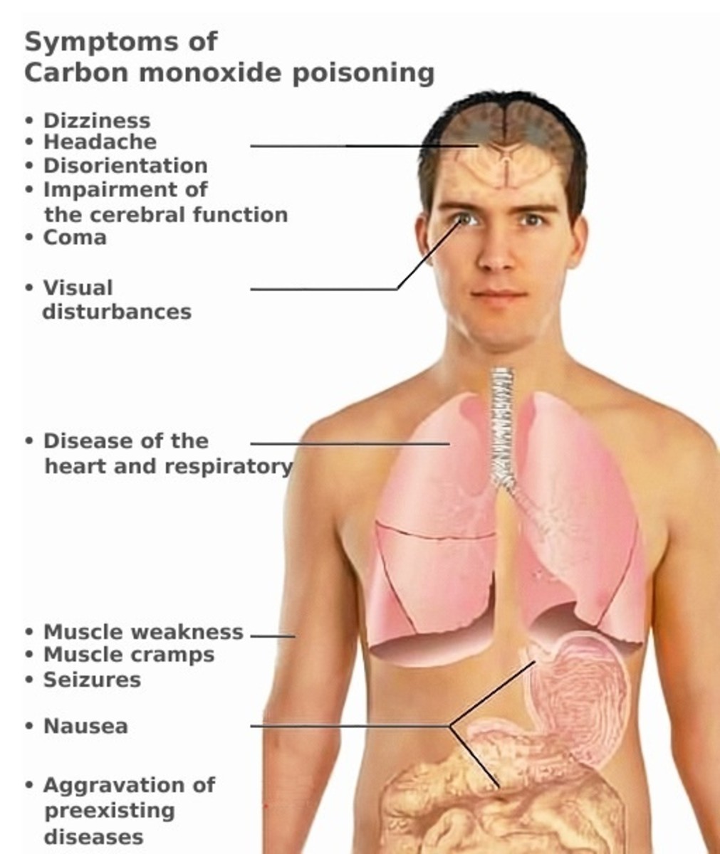 Potential symptoms of carbon monoxide poisoning