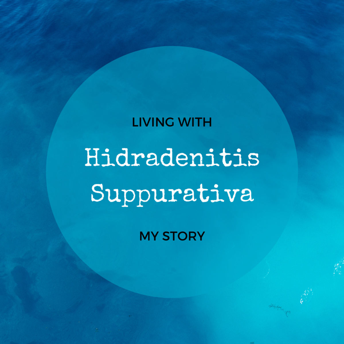 Hidradenitis Suppurativa Skin Condition: My Experience
