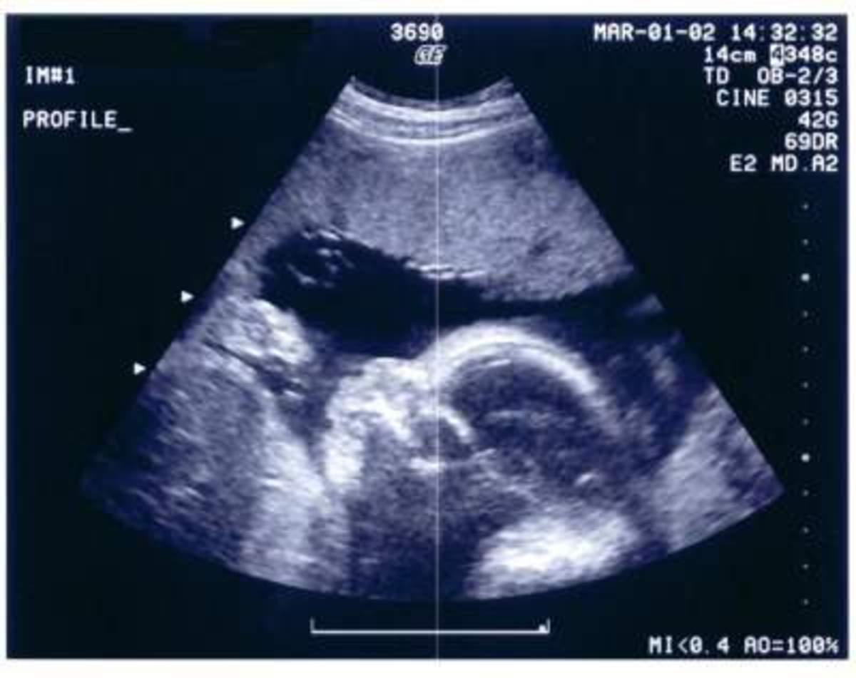 Ultrasound image: 28 weeks
