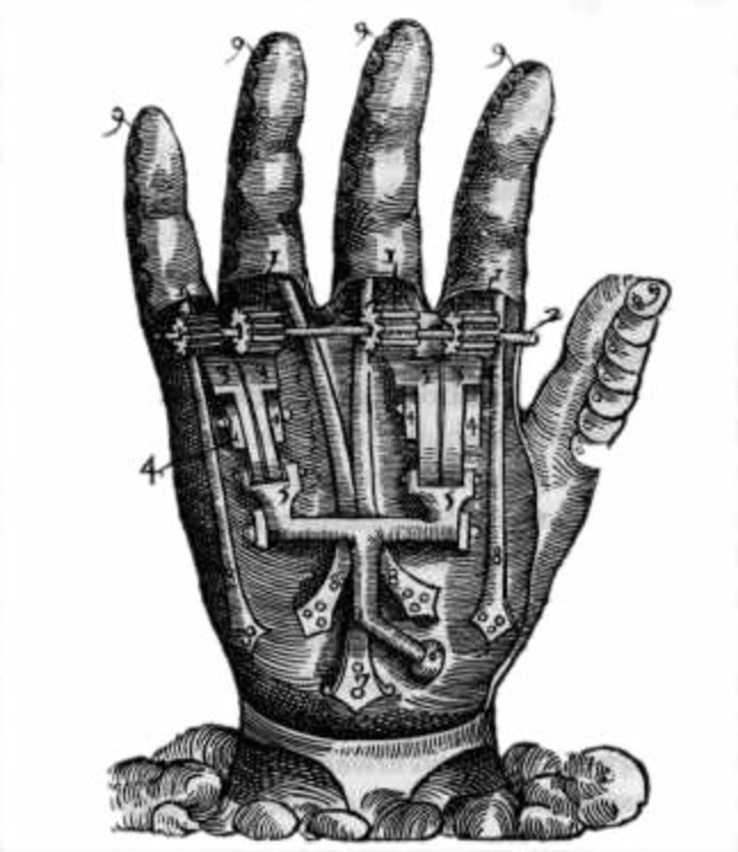 picture from: Dix livres de chirurgie (Paris 1564)