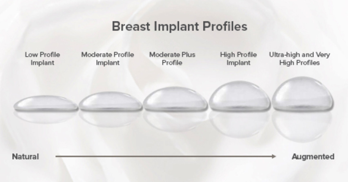 Ready for a No BS Breast Augmentation Story?
