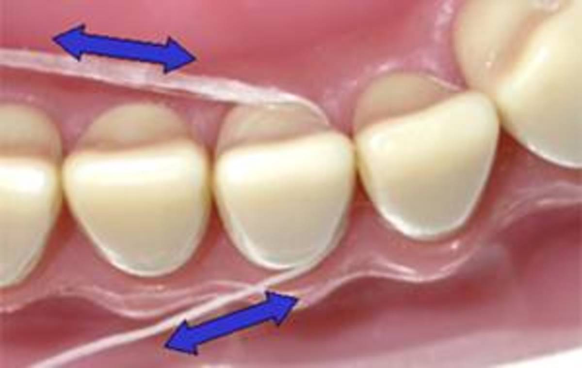 Why Your Gums Hurt After Flossing (7 Tips for Relief) HubPages