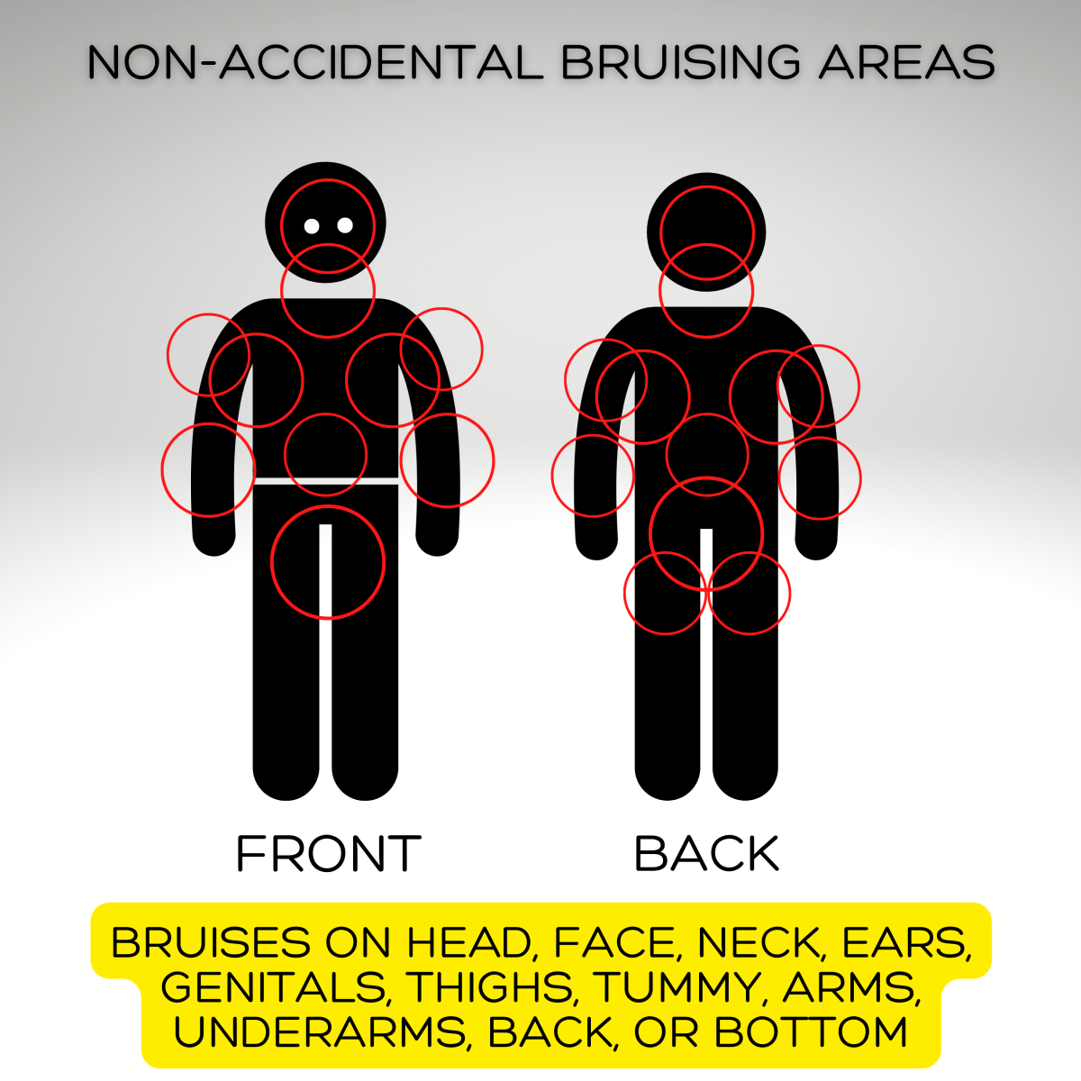 Bruises in these areas are less likely to be from normal activities. Bruises here are more often associated with abuse.