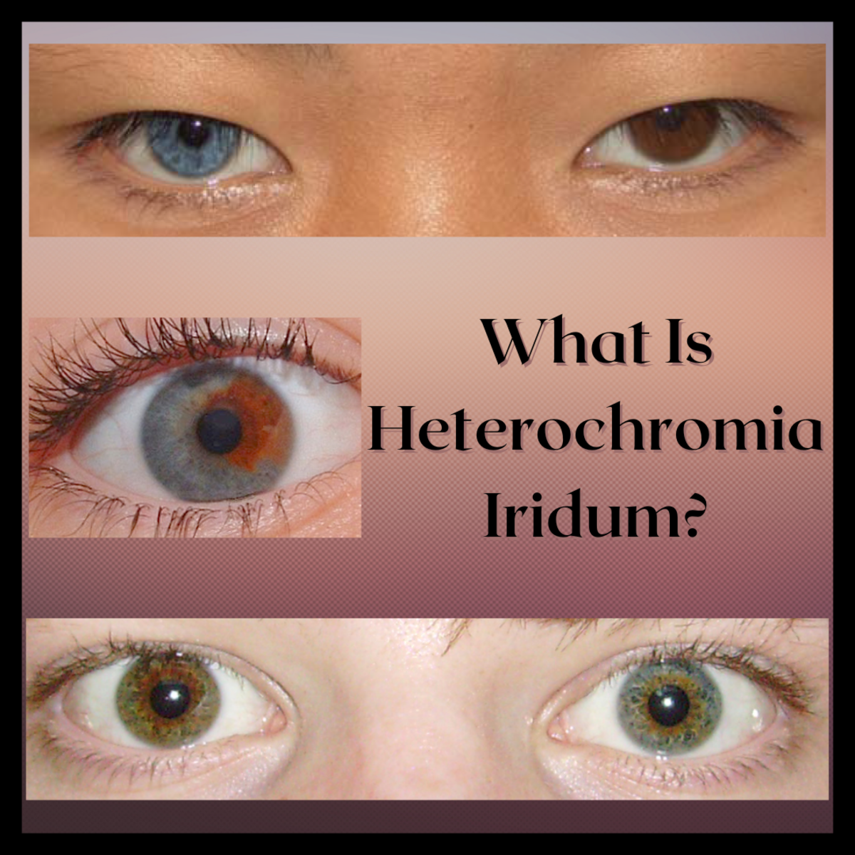 Heterochromia Iridum: People With Two Different Colored Eyes - Owlcation