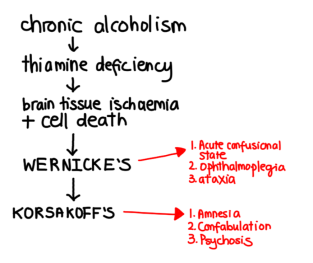 Understanding the Wet Brain Caused By Alcoholism