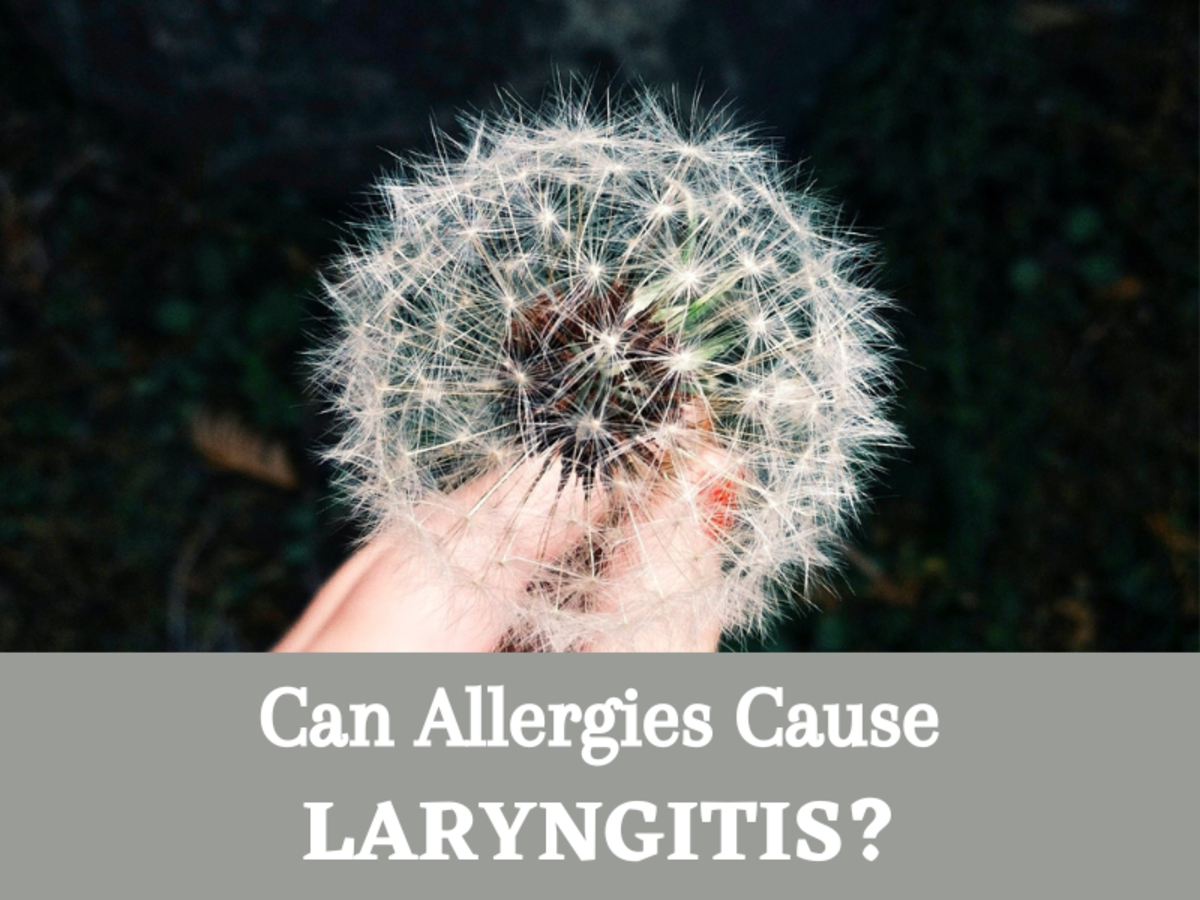Can allergies cause laryngitis?