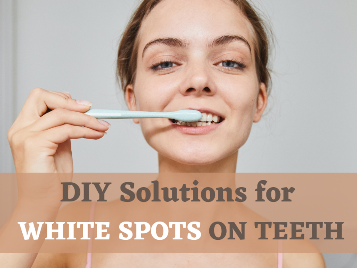 DIY Solutions for White Spots on Teeth YouMeMindBody