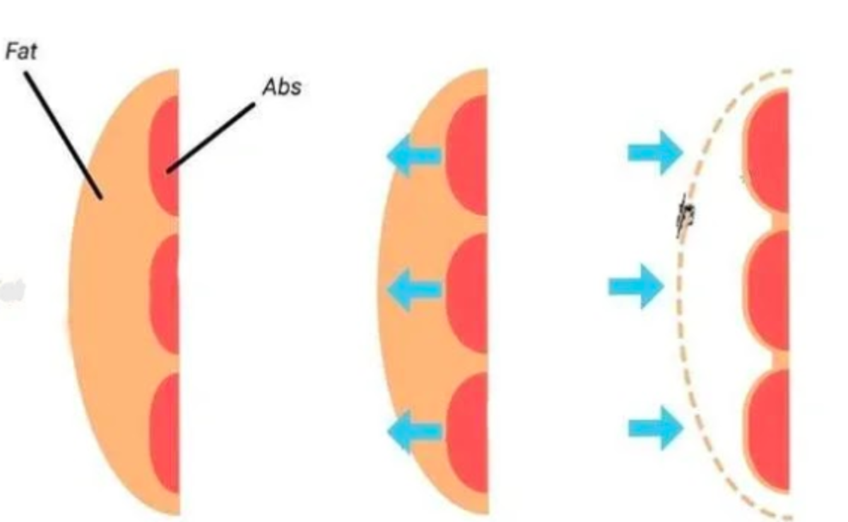 5 Reasons Your Abs Are Not Showing