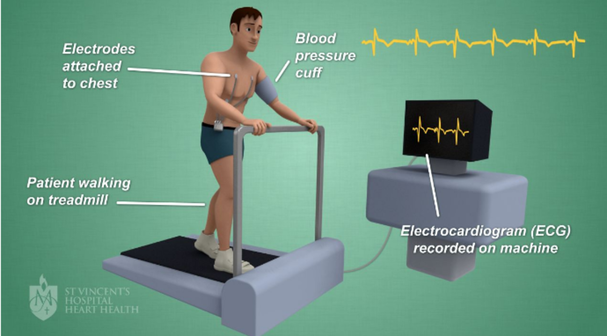 medical-tests-and-investigations-for-diagnosing-heart-diseases