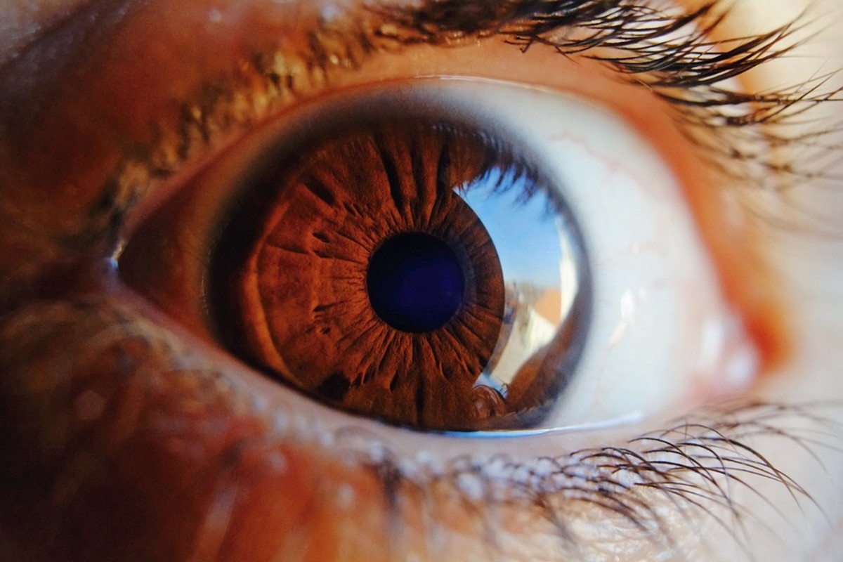 My Husband's Experience With a Retinal Tear and Macular Hole Surgery