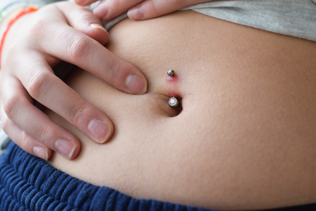 A Long List of Belly Button Piercing Problems